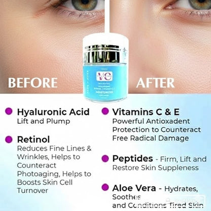 VCLINICA® Hyaluronic Acid Moisturizer with Retinol, Vit C & E, Aloe Vera & Shea Butter 2 Ounce/60ml